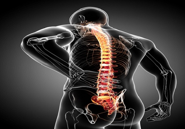 Anatomy of male back pain in black